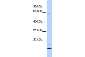 WB Suggested Anti-TCP11L2 Antibody Titration: 0. (TCP11L2 antibody  (N-Term))