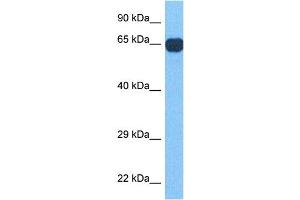 Host:  Rabbit  Target Name:  RFX4  Sample Tissue:  Human Ovary Tumor  Antibody Dilution:  1ug/ml (RFX4 antibody  (N-Term))