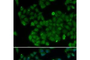 Immunofluorescence analysis of U2OS cells using DNMT3L Polyclonal Antibody (DNMT3L antibody)