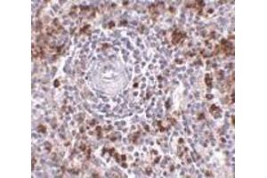 Immunohistochemistry of EBI3 in human spleen tissue with EBI3 antibody at 2. (EBI3 antibody  (C-Term))