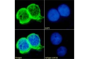 Immunofluorescence staining of Jurkat cells using anti-TAG-72 antibody Minretumomab (CC49) Immunofluorescence analysis of paraformaldehyde fixed Jurkat cells immobilized on Shi-fix™ cover-slips and stained with the chimeric rabbit IgG version of Minretumomab (CC49) (ABIN7072524) at 10 μg/mL followed by Alexa Fluor® 488 secondary antibody (2 μg/mL), showing strong membrane staining. (Recombinant TAG-72 (Minretumomab Biosimilar) antibody)