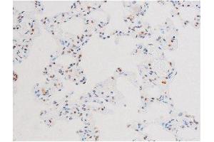 ABIN6267602 at 1/200 staining Rat lung tissue sections by IHC-P. (NF-kB p65 antibody  (pSer281))
