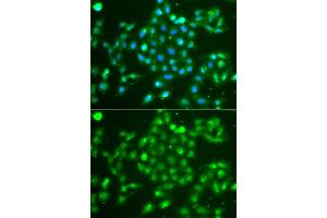 Immunofluorescence analysis of A549 cells using UCHL5 antibody. (UCHL5 antibody)