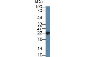 Western Blot; Sample: Human K562 cell lysate; Primary Ab: 1µg/ml Rabbit Anti-Mouse CBFb Antibody Second Ab: 0.