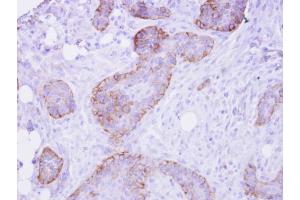 IHC-P Image FRS2 antibody detects FRS2 protein at membrane on HSC-3 xenograft by immunohistochemical analysis. (FRS2 antibody  (Center))