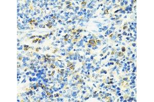 Immunohistochemistry of paraffin-embedded Rat spleen using SLC25A11 Polyclonal Antibody at dilution of 1:100 (40x lens).