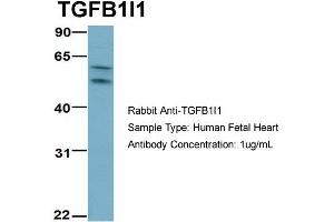 Western Blotting (WB) image for anti-Transforming Growth Factor beta 1 Induced Transcript 1 (TGFB1I1) (Middle Region) antibody (ABIN2777947)