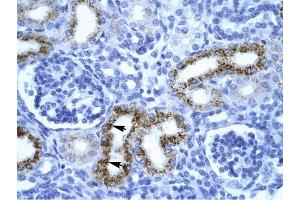 SERPINF1 antibody was used for immunohistochemistry at a concentration of 4-8 ug/ml to stain Epithelial cells of renal tubule (arrows) in Human Kidney.