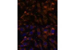 Immunofluorescence analysis of U-2 OS cells using SUCLG2 Polyclonal Antibody  at dilution of 1:100 (40x lens). (SUCLG2 antibody  (AA 50-300))