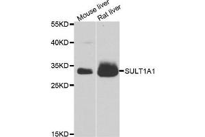 Western blot analysis of extracts of various cell lines, using SULT1A1 antibody. (SULT1A1 antibody  (AA 1-295))
