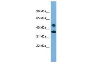 Image no. 1 for anti-SET Domain Containing 6 (SETD6) (AA 359-408) antibody (ABIN6743580) (SETD6 antibody  (AA 359-408))