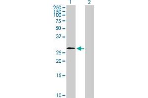 Western Blot analysis of WBP2NL expression in transfected 293T cell line by WBP2NL MaxPab polyclonal antibody. (WBP2NL antibody  (AA 1-309))
