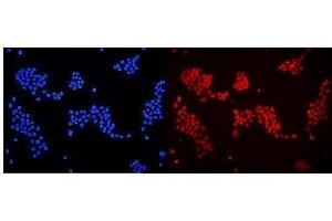 IF analysis of DDB1 using anti-DDB1 antibody (ABIN3043823). (DDB1 antibody  (AA 1011-1140))