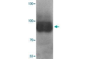 Western blot analysis of TRPV1 in K-562 cell lysate with TRPV1 polyclonal antibody  at 1 ug/mL. (TRPV1 antibody  (C-Term))