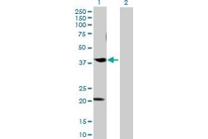 Western Blot analysis of CABLES1 expression in transfected 293T cell line by CABLES1 MaxPab polyclonal antibody. (CABLES1 antibody  (AA 1-368))