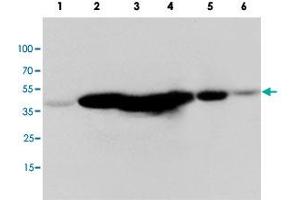 Western blot analysis of tissue and whole cell extracts with MAP2K1 polyclonal antibody . (MEK1 antibody  (C-Term))