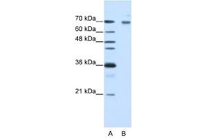 FZD7 antibody used at 1 ug/ml to detect target protein. (FZD7 antibody)