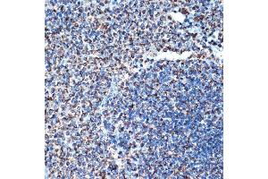 Immunohistochemistry of paraffin-embedded rat spleen using DCR2 Rabbit mAb (ABIN7271063) at dilution of 1:100 (40x lens). (DcR2 antibody)