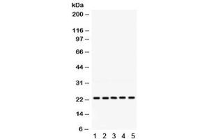 Western blot testing of 1) rat testis, 2) rat lung, 3) human 293, 4) human HeLa and 5) human HepG2 lysate with RAB18 antibody.