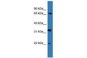 Western Blot showing DOK4 antibody used at a concentration of 1-2 ug/ml to detect its target protein. (DOK4 antibody  (N-Term))