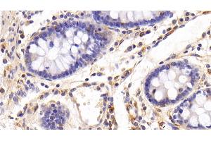 Detection of FAS in Porcine Colon Tissue using Polyclonal Antibody to Factor Related Apoptosis (FAS) (FAS antibody)