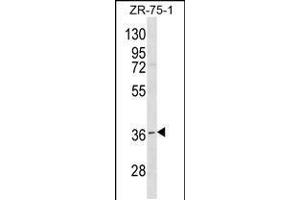 Western blot analysis in ZR-75-1 cell line lysates (35ug/lane). (RNF144B antibody  (AA 90-118))