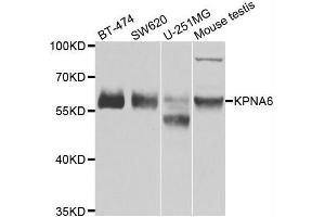 Western blot analysis of extracts of various cell lines, using KPNA6 antibody. (KPNA6 antibody  (AA 277-536))