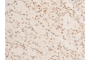 Immunohistochemistry (IHC) image for anti-Nuclear Factor of kappa Light Polypeptide Gene Enhancer in B-Cells Inhibitor, alpha (NFKBIA) (pSer32), (pSer36) antibody (ABIN6256292)