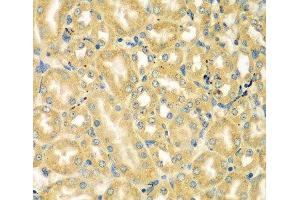 Immunohistochemistry of paraffin-embedded Mouse kidney using MOCS3 Polyclonal Antibody at dilution of 1:100 (40x lens).