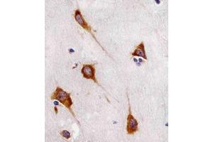 (ABIN6243853 and ABIN6577112) staining FA in human brain sections by Immunohistochemistry (IHC-P - paraformaldehyde-fixed, paraffin-embedded sections). (FAM120A antibody)