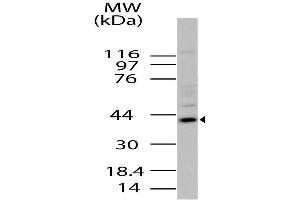 Image no. 1 for anti-Radical S-Adenosyl Methionine Domain Containing 2 (RSAD2) (AA 100-330) antibody (ABIN5027637) (RSAD2 antibody  (AA 100-330))
