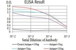 Black line: Control Antigen (100 ng);Purple line: Antigen (10ng); Blue line: Antigen (50 ng); Red line:Antigen (100 ng) (SOD2 antibody  (AA 1-222))