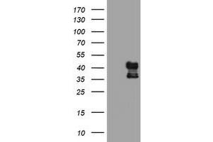 HEK293T cells were transfected with the pCMV6-ENTRY control (Left lane) or pCMV6-ENTRY PDSS2 (Right lane) cDNA for 48 hrs and lysed. (PDSS2 antibody)