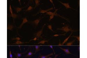 Immunofluorescence analysis of C6 cells using PRKAB2 Polyclonal Antibody at dilution of 1:100 (40x lens). (PRKAB2 antibody)