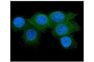 IF analysis of RAB27A using anti-RAB27A antibody (ABIN7602714). (RAB27A antibody  (AA 98-216))