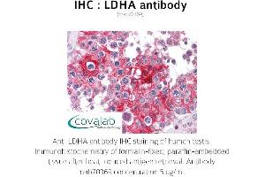 Image no. 1 for anti-Lactate Dehydrogenase A (LDHA) antibody (ABIN1724372) (Lactate Dehydrogenase A antibody)