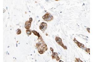 ABIN6268773 at 1/100 staining human breast tissue sections by IHC-P. (KRT14 antibody  (N-Term))