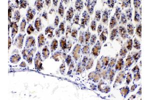 IHC analysis of TFF3 using anti-TFF3 antibody . (TFF3 antibody  (AA 23-81))