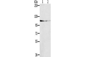 Gel: 6 % SDS-PAGE, Lysate: 40 μg, Lane 1-2: 823 cells, hepg2 cells, Primary antibody: ABIN7129263(DSTYK Antibody) at dilution 1/200, Secondary antibody: Goat anti rabbit IgG at 1/8000 dilution, Exposure time: 1 minute (DSTYK antibody)