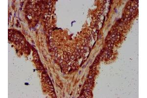 Immunohistochemistry (IHC) image for anti-Smg-7 Homolog, Nonsense Mediated mRNA Decay Factor (SMG7) (AA 694-809) antibody (ABIN7166132)