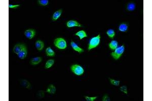 Immunofluorescence staining of A549 cells with ABIN7158018 at 1:33, counter-stained with DAPI. (FAM89B antibody  (AA 1-162))