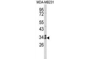 Western Blotting (WB) image for anti-Clathrin, Light Chain A (CLTA) antibody (ABIN3004002) (CLTA antibody)
