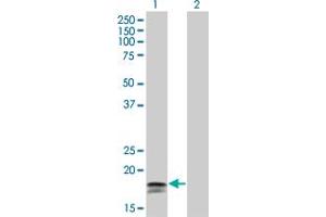 Western Blot analysis of IFNA2 expression in transfected 293T cell line by IFNA2 monoclonal antibody (M33), clone 4H3. (IFNA2 antibody  (AA 24-188))