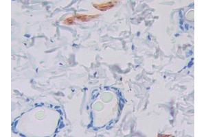 Used in DAB staining on fromalin fixed paraffin- embedded stomach tissue (PIP antibody  (AA 41-139))