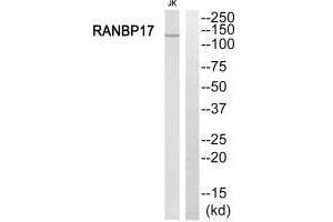 Western blot analysis of extracts from Jurkat cells, using RANBP17 antibody. (RANBP17 antibody  (N-Term))