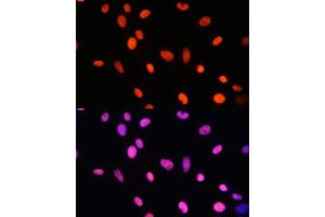 Immunofluorescence (IF) image for anti-Histone H2B (meLys5) antibody (ABIN7267735)