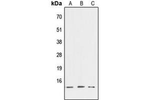 Western blot analysis of ATP6V1G3 expression in HEK293T (A), NIH3T3 (B), PC12 (C) whole cell lysates. (ATP6V1G3i antibody  (Center))
