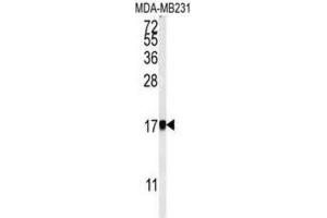 Western Blotting (WB) image for anti-Adaptor Related Protein Complex 1 sigma 1 (AP1S1) antibody (ABIN3002203)