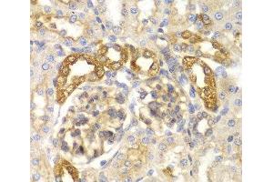 Immunohistochemistry of paraffin-embedded Rat kidney using ASC / TMS1 Polyclonal Antibody at dilution of 1:100 (40x lens). (PYCARD antibody)
