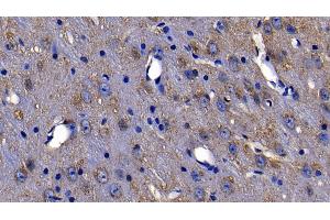 Immunohistochemistry (IHC) image for anti-Lymphocyte Antigen 96 (LY96) (AA 19-130) antibody (ABIN7436531)